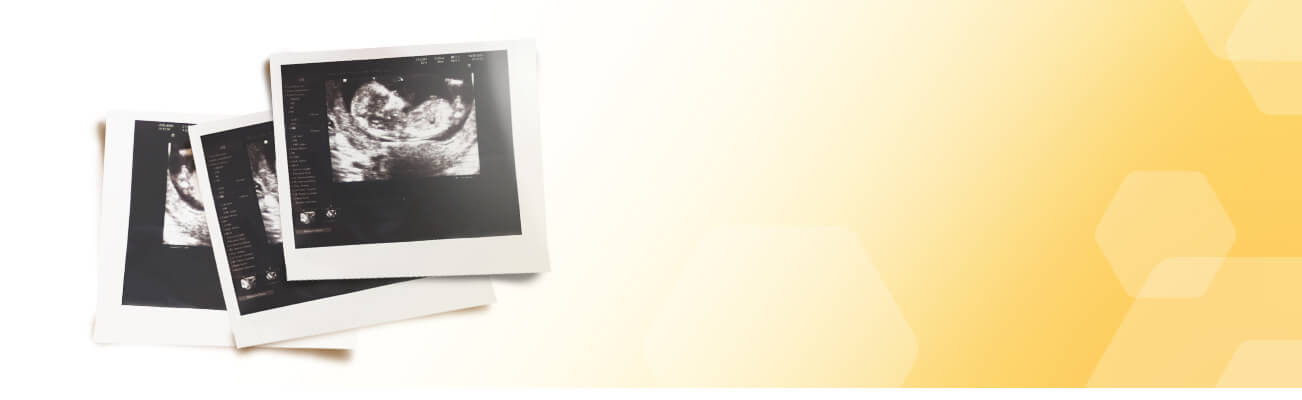 Your Pregnancy Journey