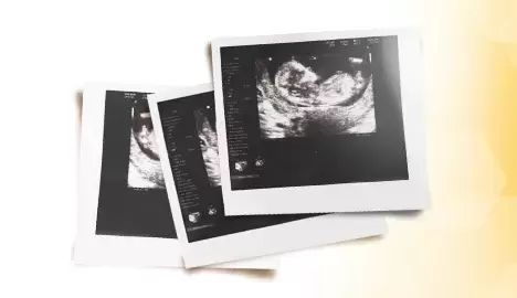 Your Pregnancy Journey